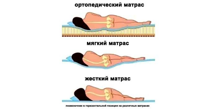 Tilam yang salah akan menimbulkan banyak masalah